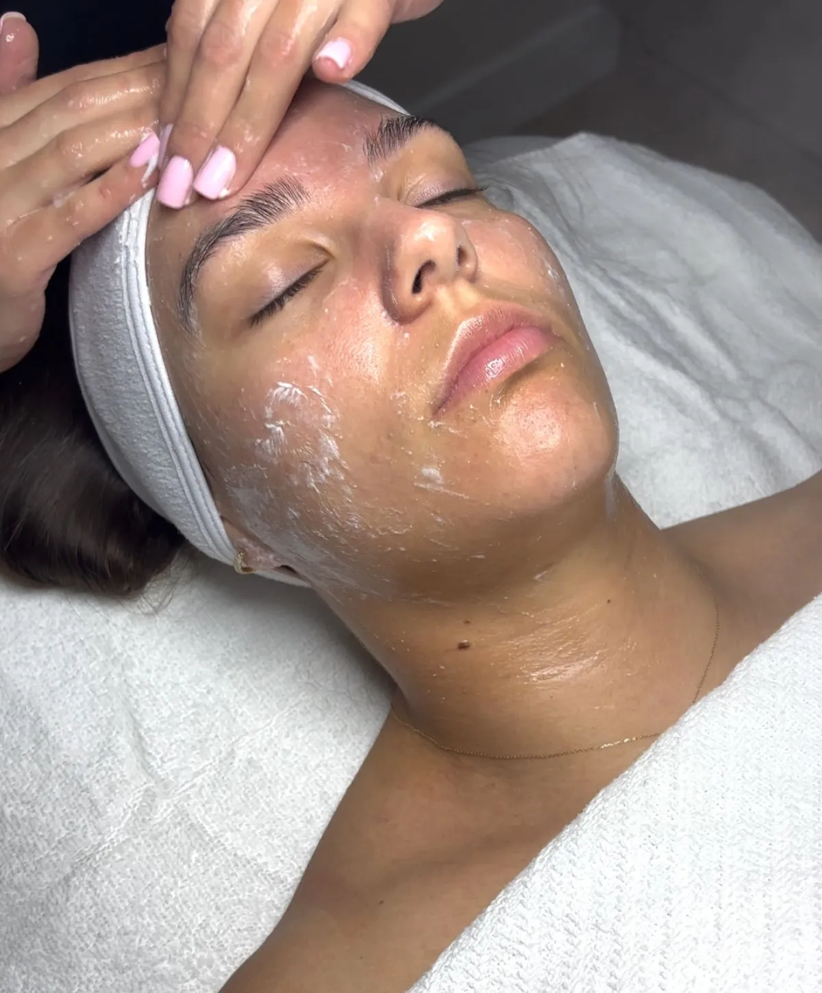 Burbank facials patient receiving treatment