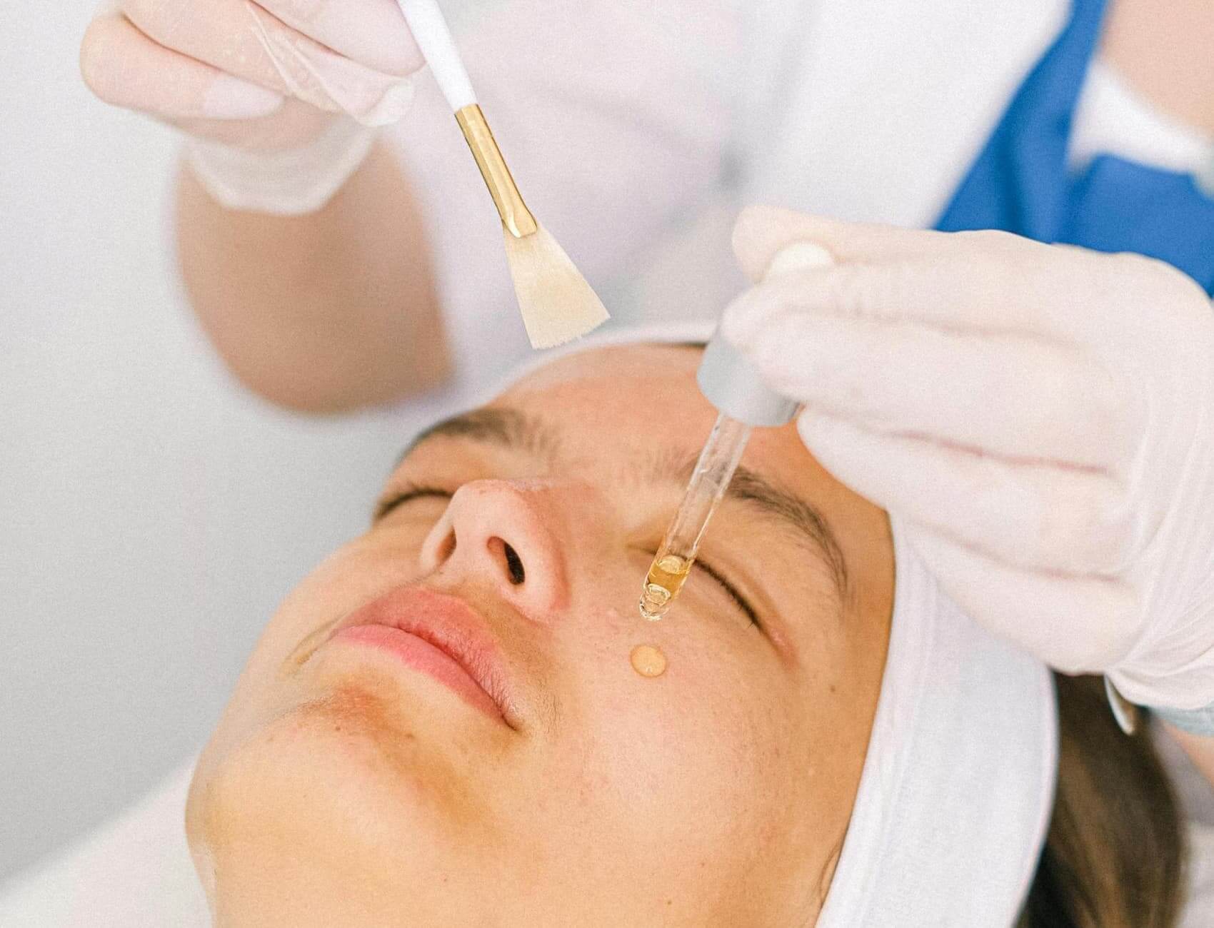 Chemical peel