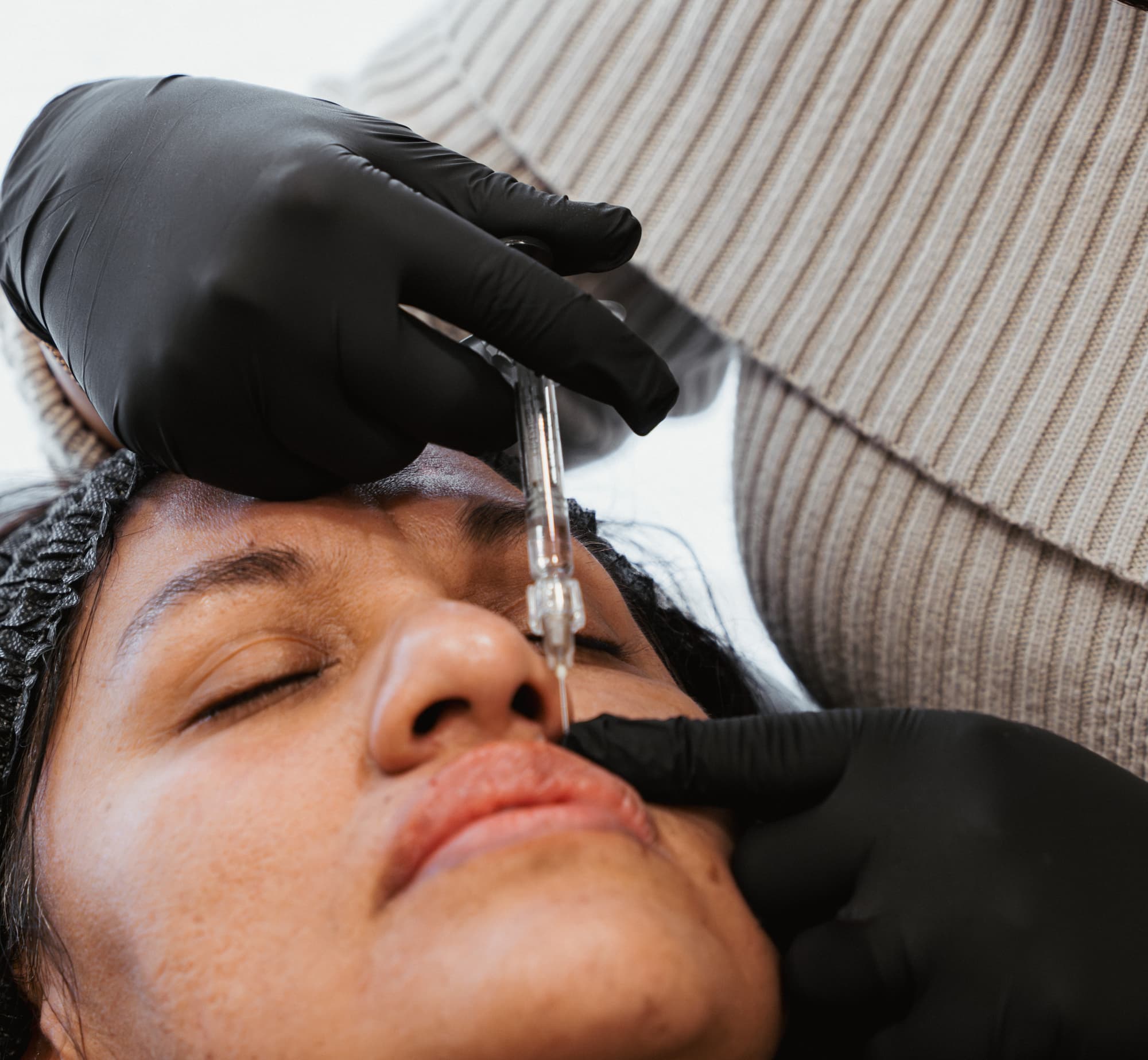 Dermal filler