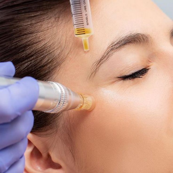 PRP Facial vs Microneedling: Which Is Right for You?