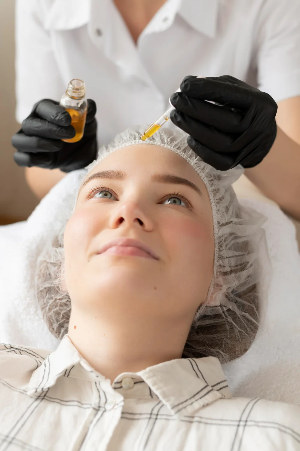 chemical peels